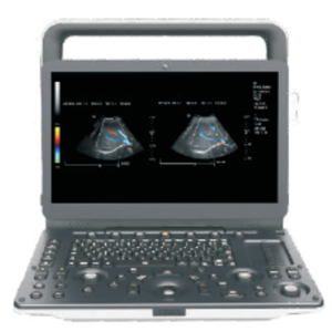 Ecógrafo Portátil a color M30